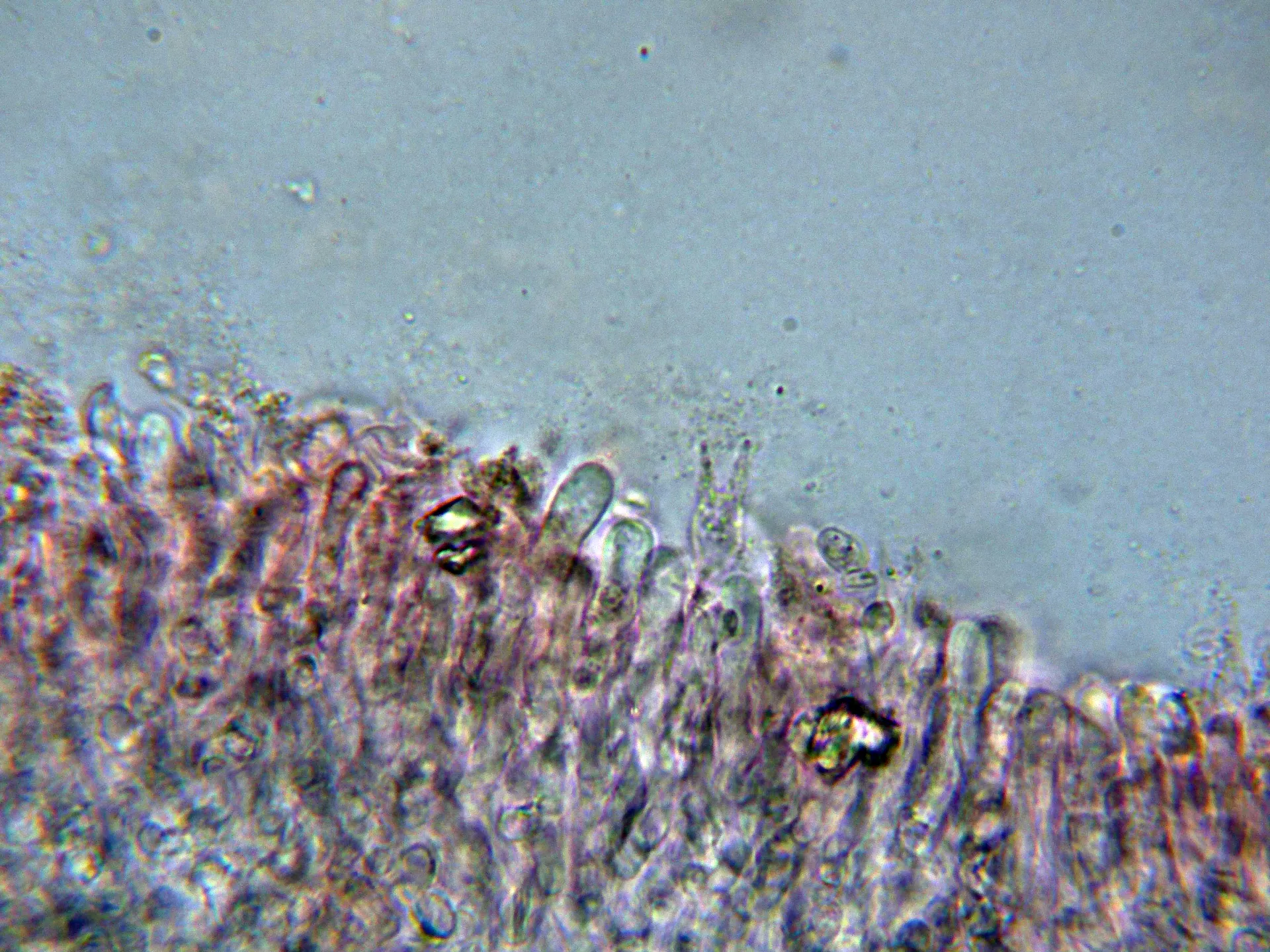 Microscopía de Tephroderma fuscopallens - 10 - Arista laminar-001